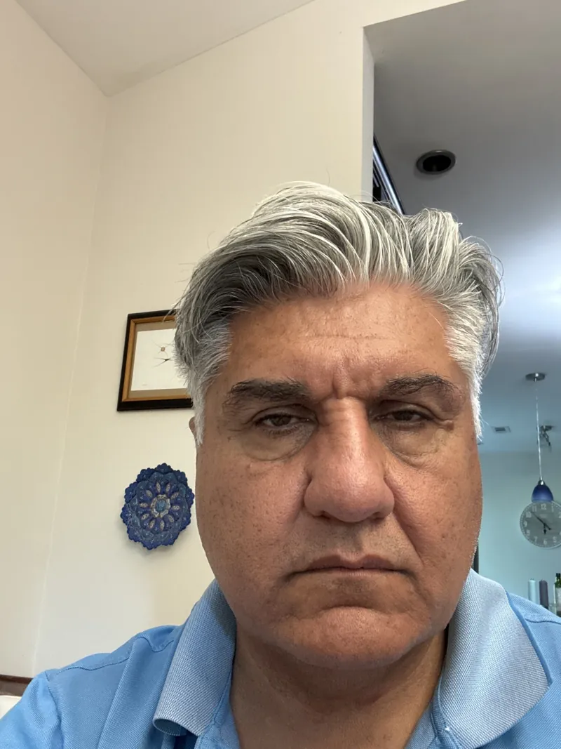 Original photo before Lip Filler