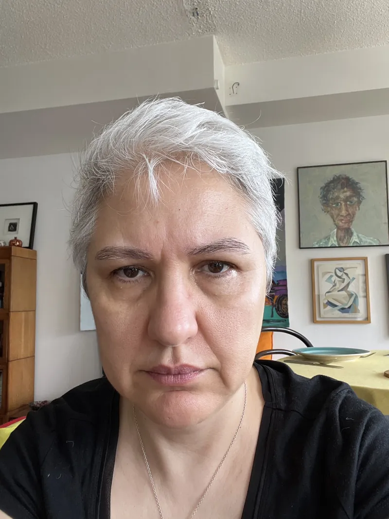 Original photo before HydraFacial